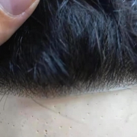 Protesi capelli umani europei capelli impiantati crescita naturale invisibile ultra lèggerà sistema d attacco 4 settimane 
